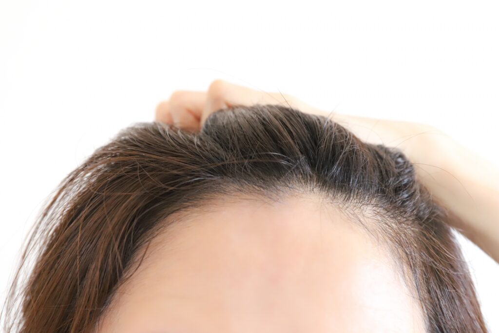 顔の産毛処理の正しい方法|透明感と化粧ノリを手に入れる秘訣│美容情報サイト Beauty Web(ビューティーウェブ)