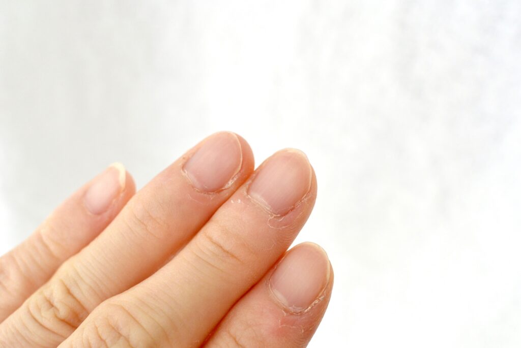 ネイルオフ後に爪が傷む原因とは?正しいケアで健康な指先を守る│美容情報サイト Beauty Web(ビューティーウェブ)