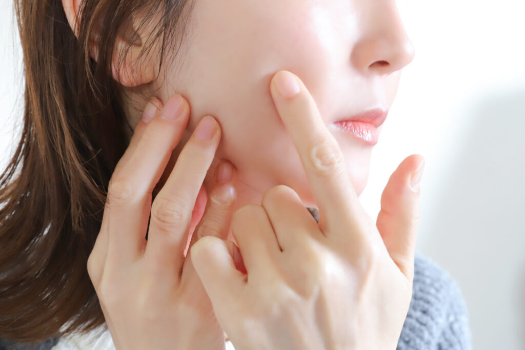 ニキビは触らない方がいい理由と正しいケア方法！│美容情報サイト Beauty Web(ビューティーウェブ)