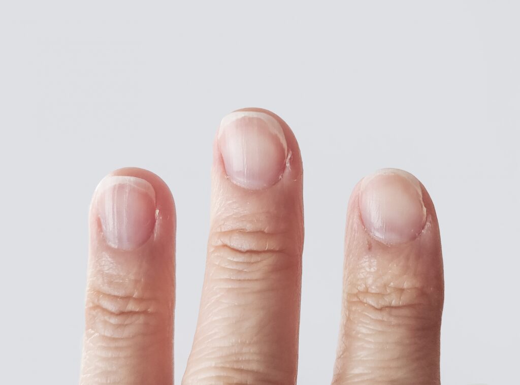 爪の縦筋が目立つ原因と対策を徹底解説！自宅でできるケアと予防方法│美容情報サイト Beauty Web(ビューティーウェブ)