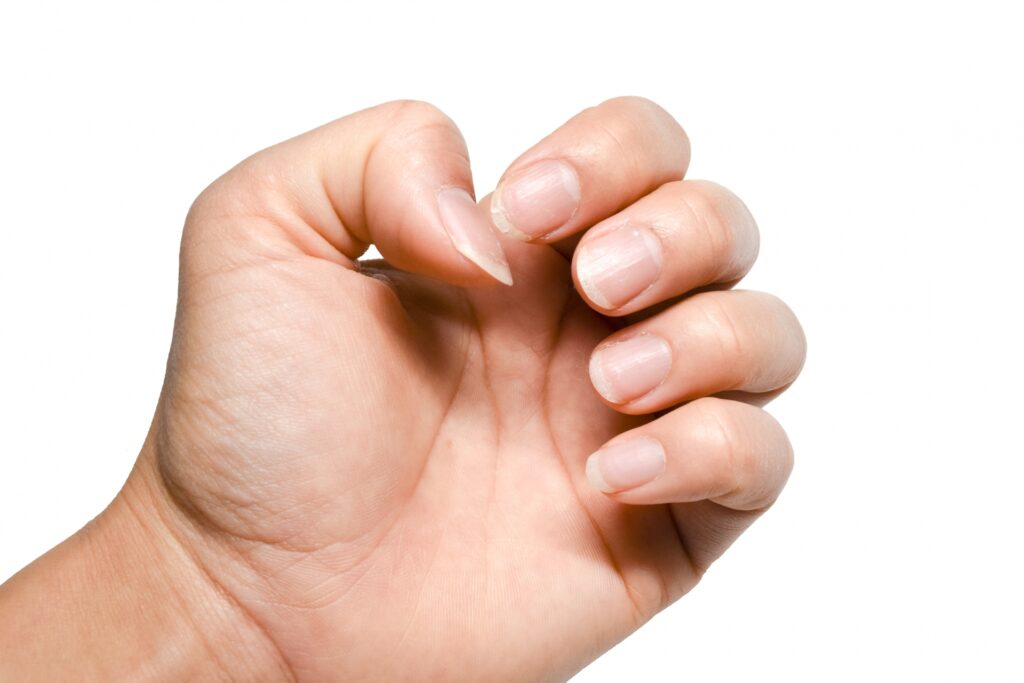 ネイルの先端が欠ける原因と対処法!今すぐ直す方法と長持ちさせるコツ│美容情報サイト Beauty Web(ビューティーウェブ)