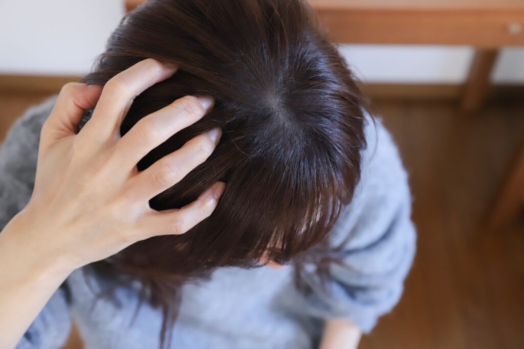 頭皮が乾燥してかゆい女性へ｜原因と今日から見直したいヘアケア方法│美容情報サイト Beauty Web(ビューティーウェブ)
