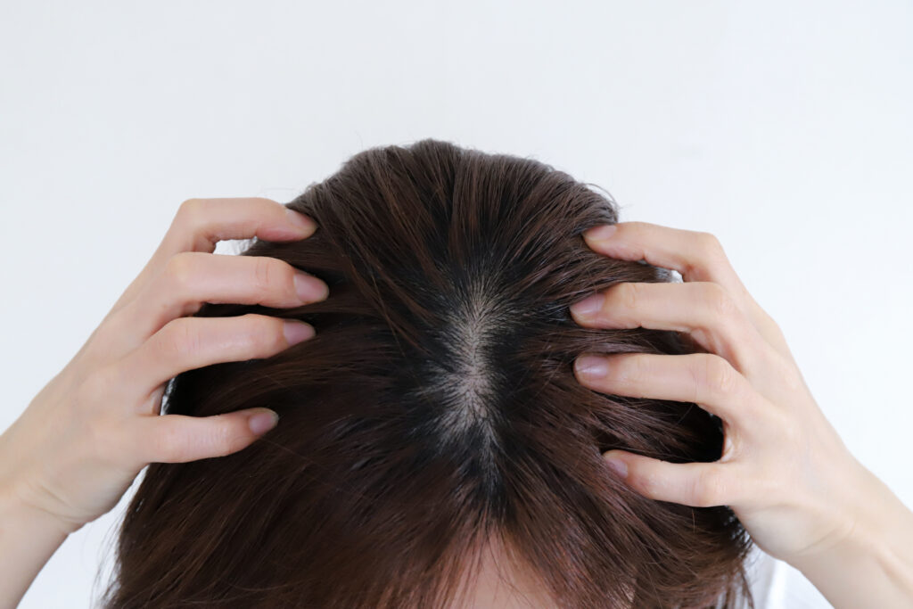 頭皮が乾燥してかゆい女性へ｜原因と今日から見直したいヘアケア方法│美容情報サイト Beauty Web(ビューティーウェブ)