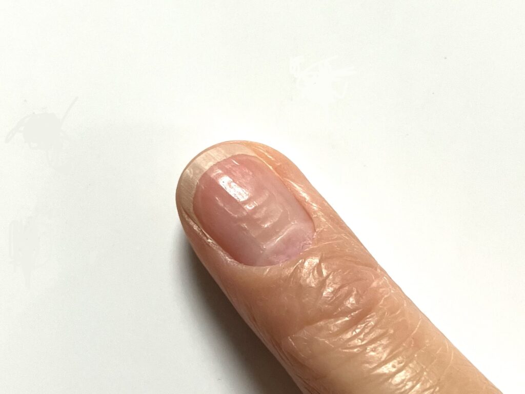 甘皮処理のやりすぎサインとは?爪を傷めない正しい見直し方│美容情報サイト Beauty Web(ビューティーウェブ)
