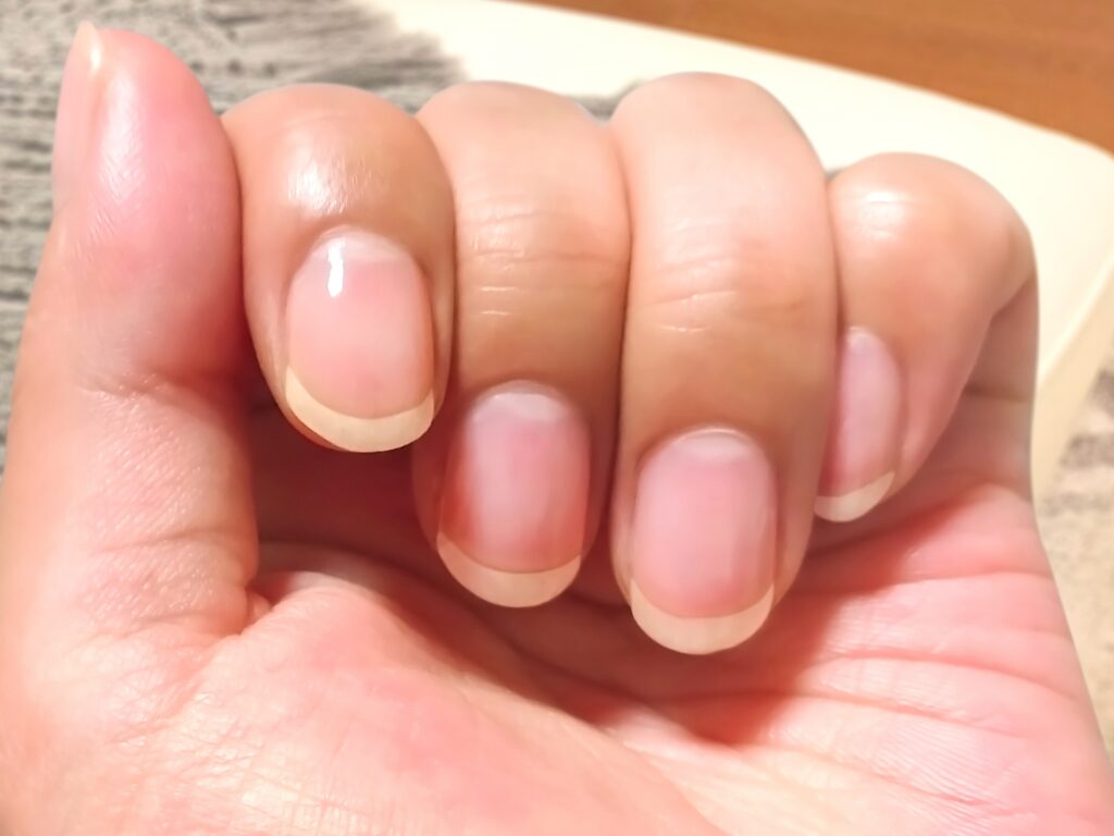 甘皮処理のやりすぎサインとは?爪を傷めない正しい見直し方│美容情報サイト Beauty Web(ビューティーウェブ)